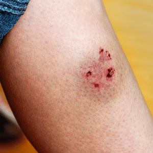 dog bite katy, texas